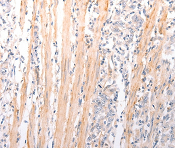 ABCA2 Antibody in Immunohistochemistry (Paraffin) (IHC (P))