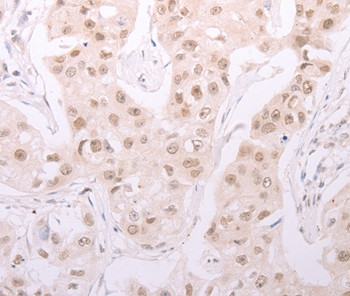 ADAM12 Antibody in Immunohistochemistry (Paraffin) (IHC (P))