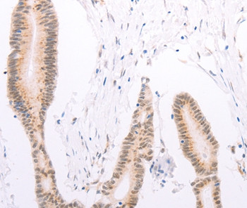 ADAM12 Antibody in Immunohistochemistry (Paraffin) (IHC (P))