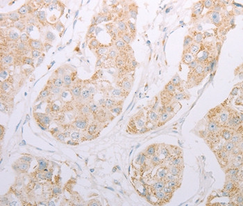 ADAM28 Antibody in Immunohistochemistry (Paraffin) (IHC (P))