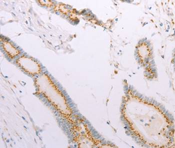 ADAM28 Antibody in Immunohistochemistry (Paraffin) (IHC (P))