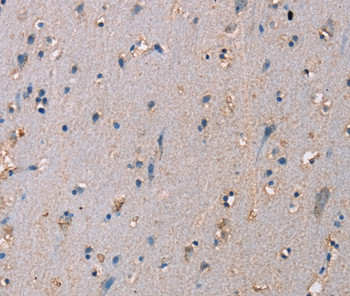 ADAM29 Antibody in Immunohistochemistry (Paraffin) (IHC (P))