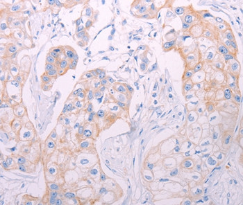 ADAMTS14 Antibody in Immunohistochemistry (Paraffin) (IHC (P))