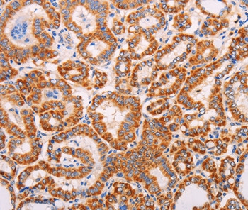 ADAMTS17 Antibody in Immunohistochemistry (Paraffin) (IHC (P))