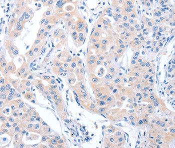 ARHGEF6 Antibody in Immunohistochemistry (Paraffin) (IHC (P))