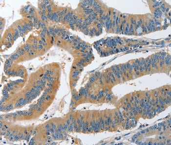 PIK3R4 Antibody in Immunohistochemistry (Paraffin) (IHC (P))