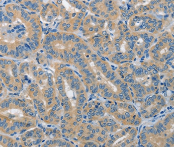 PIK3R4 Antibody in Immunohistochemistry (Paraffin) (IHC (P))