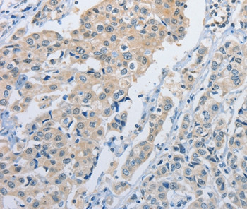 NEK9 Antibody in Immunohistochemistry (Paraffin) (IHC (P))