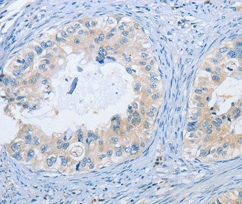 NEK9 Antibody in Immunohistochemistry (Paraffin) (IHC (P))