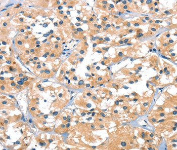 SLC6A4 Antibody in Immunohistochemistry (Paraffin) (IHC (P))