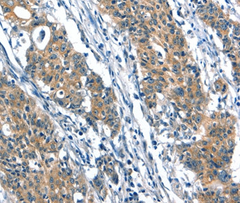 A4GALT Antibody in Immunohistochemistry (Paraffin) (IHC (P))