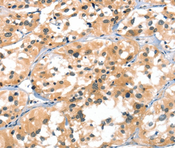 A4GALT Antibody in Immunohistochemistry (Paraffin) (IHC (P))