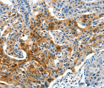 COG1 Antibody in Immunohistochemistry (Paraffin) (IHC (P))