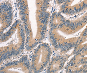 CRIM1 Antibody in Immunohistochemistry (Paraffin) (IHC (P))