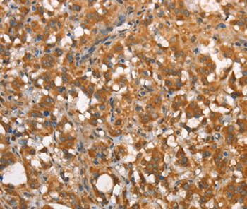 CALCRL Antibody in Immunohistochemistry (Paraffin) (IHC (P))