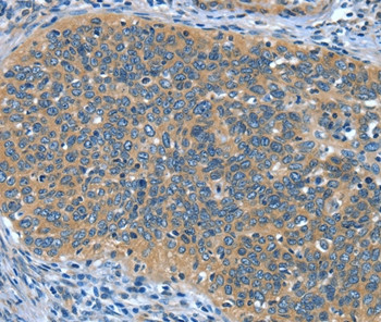 DTX1 Antibody in Immunohistochemistry (Paraffin) (IHC (P))