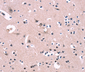 FGF16 Antibody in Immunohistochemistry (Paraffin) (IHC (P))