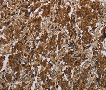 FGF20 Antibody in Immunohistochemistry (Paraffin) (IHC (P))