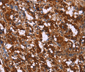 GAGE12I Antibody in Immunohistochemistry (Paraffin) (IHC (P))