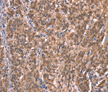 GCSAM Antibody in Immunohistochemistry (Paraffin) (IHC (P))