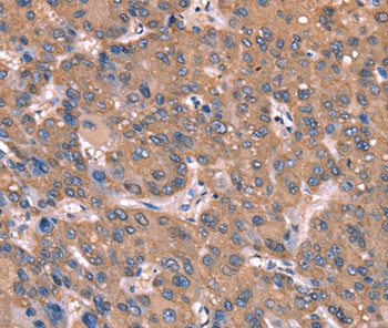 GCSAM Antibody in Immunohistochemistry (Paraffin) (IHC (P))