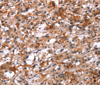 Glucagon Receptor Antibody in Immunohistochemistry (Paraffin) (IHC (P))