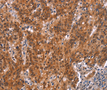 GNAT3 Antibody in Immunohistochemistry (Paraffin) (IHC (P))