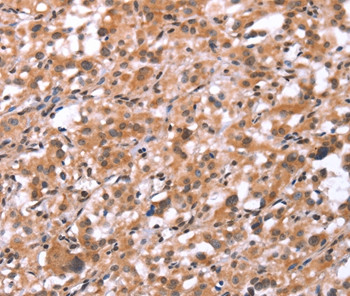 GNAT3 Antibody in Immunohistochemistry (Paraffin) (IHC (P))