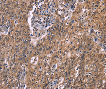 HSD11B2 Antibody in Immunohistochemistry (Paraffin) (IHC (P))