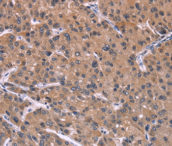 HSD11B2 Antibody in Immunohistochemistry (Paraffin) (IHC (P))