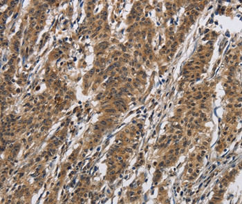 IL12RB2 Antibody in Immunohistochemistry (Paraffin) (IHC (P))