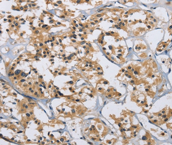 IL12RB2 Antibody in Immunohistochemistry (Paraffin) (IHC (P))