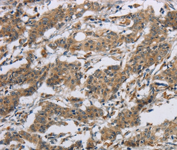 Synapsin 2 Antibody in Immunohistochemistry (Paraffin) (IHC (P))