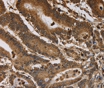 ITPR3 Antibody in Immunohistochemistry (Paraffin) (IHC (P))