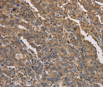 KCNG1 Antibody in Immunohistochemistry (Paraffin) (IHC (P))