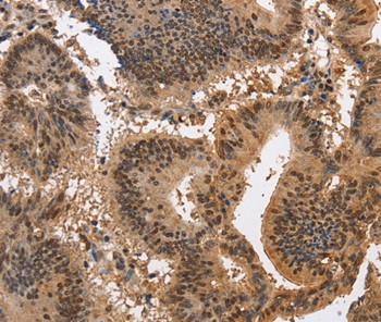 KCNG2 Antibody in Immunohistochemistry (Paraffin) (IHC (P))