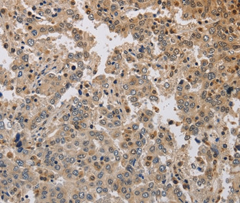 KCNG3 Antibody in Immunohistochemistry (Paraffin) (IHC (P))