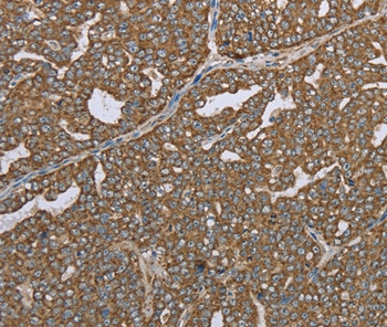 Lass4 Antibody in Immunohistochemistry (Paraffin) (IHC (P))