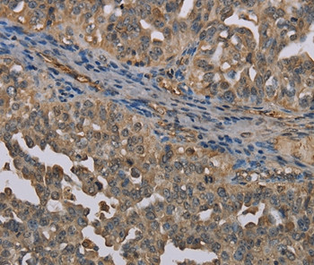 UBP1 Antibody in Immunohistochemistry (Paraffin) (IHC (P))