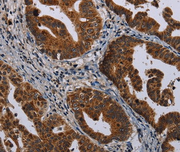 MAGEB3 Antibody in Immunohistochemistry (Paraffin) (IHC (P))