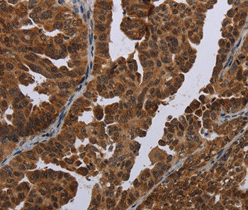 MAGEB3 Antibody in Immunohistochemistry (Paraffin) (IHC (P))