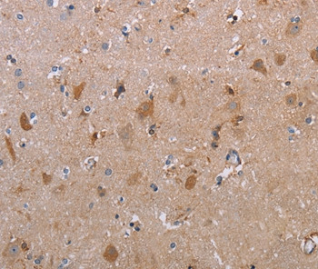 MAGEF1 Antibody in Immunohistochemistry (Paraffin) (IHC (P))