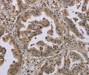 MCC Antibody in Immunohistochemistry (Paraffin) (IHC (P))