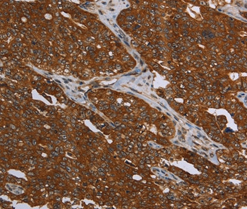 MCHR1 Antibody in Immunohistochemistry (Paraffin) (IHC (P))