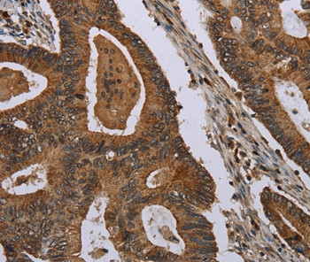 BCAR3 Antibody in Immunohistochemistry (Paraffin) (IHC (P))