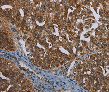 BCAR3 Antibody in Immunohistochemistry (Paraffin) (IHC (P))