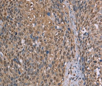 CAB39 Antibody in Immunohistochemistry (Paraffin) (IHC (P))