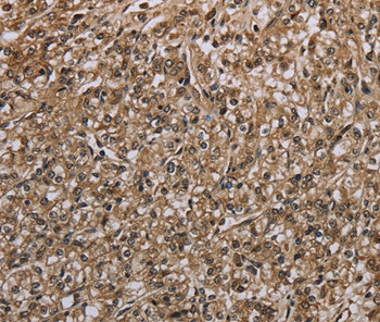 MYO18B Antibody in Immunohistochemistry (Paraffin) (IHC (P))