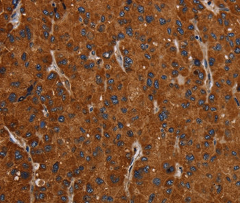 SLC22A12 Antibody in Immunohistochemistry (Paraffin) (IHC (P))