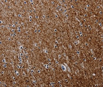 PCDHAC1 Antibody in Immunohistochemistry (Paraffin) (IHC (P))